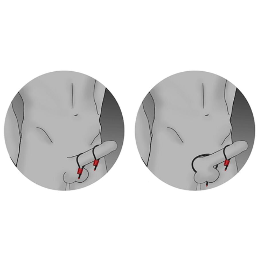 ELECTRASTIM - PRESTIGE ELECTRA LOOPS ADJUSTABLE RED COCK RINGS